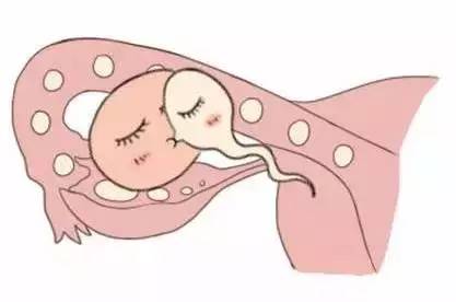 妇科